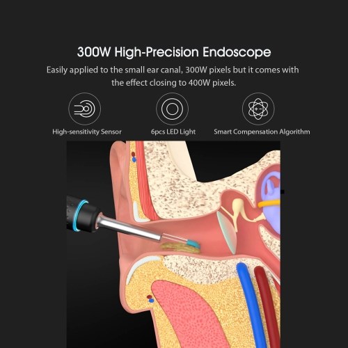 

Bebird Smart Visual Ear Stick M9 Pro Multifunctional 17 Picking Heads 300W High Precision Endoscope