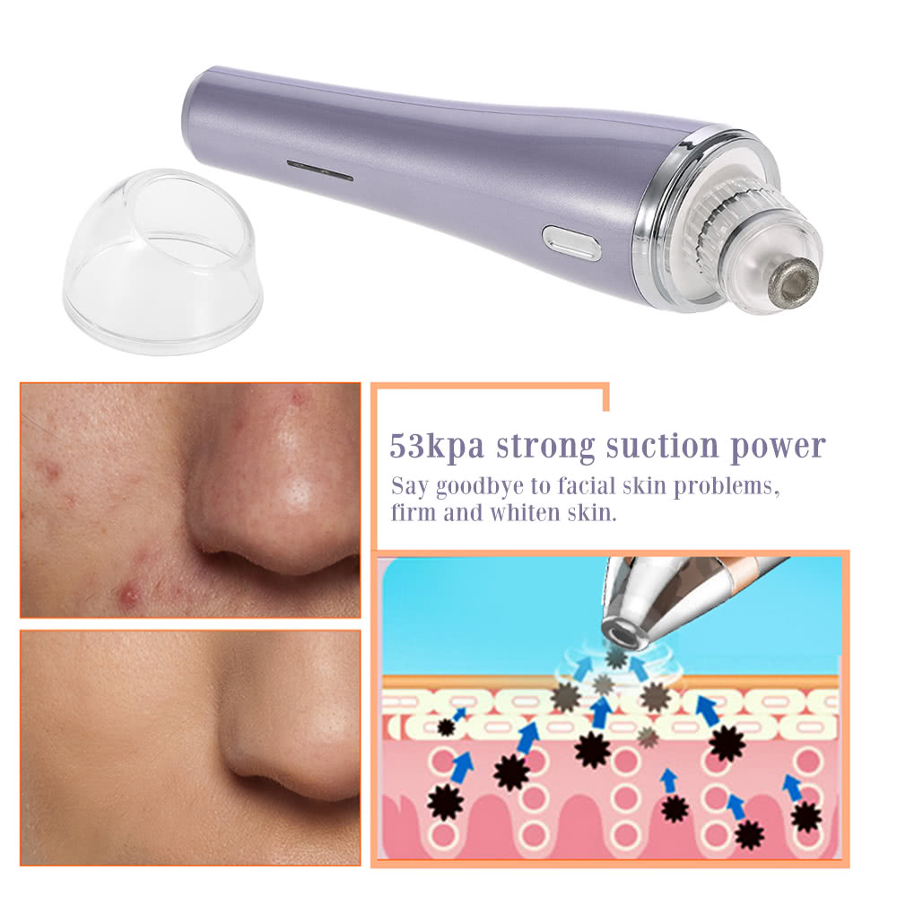 Why Does My Butt Itch Facial Pore Suction