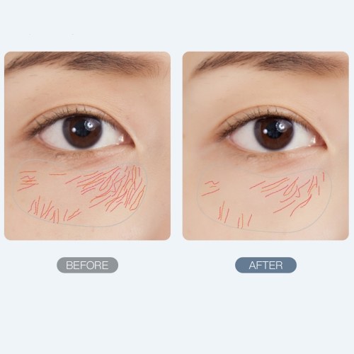

Wellskins Eye Radio Frequency Beauty Instrument WX-SP500