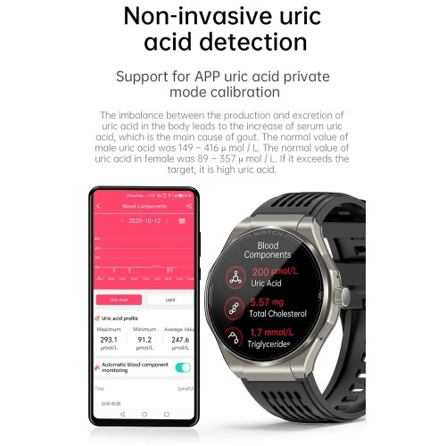 1.43-inch AMOLED Screen Smartwatch BT Talk/Non-invasive Glucose/Uric Acid/Lipids/Blood Pressure/ECG/Built-in 295mAh Li-ion Battery 