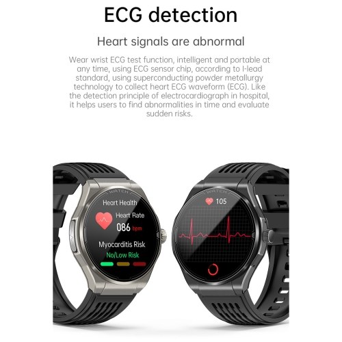 1.43-inch AMOLED Screen Smartwatch BT Talk/Non-invasive Glucose/Uric Acid/Lipids/Blood Pressure/ECG/Built-in 295mAh Li-ion Battery 