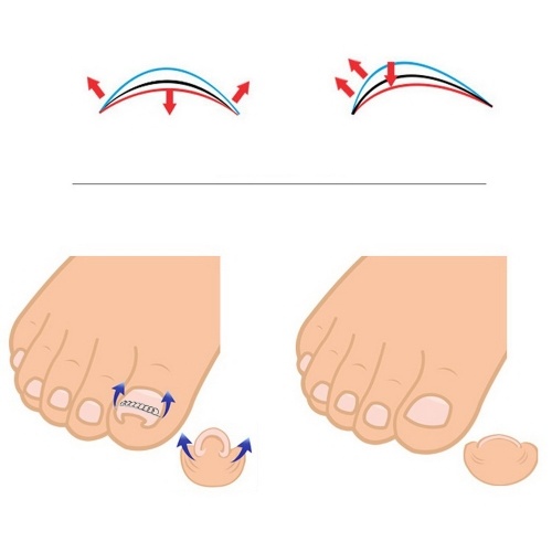 thumb