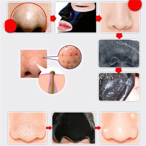 

Mineral Mud Material Deep Cleansing Skin Remove Blackheads