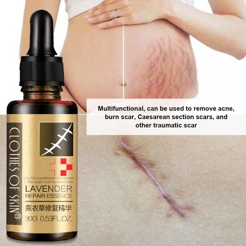 

Lavender Repair Essence Oil Dilute Remove Cream