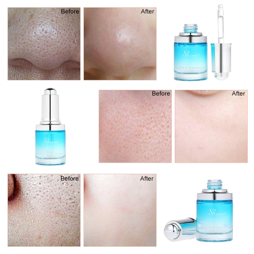 

Nicoross 30ml Concentrate Essence Pores Repair Firming Hydrating Blackhead Remover Derived Whitening Facial Shrink