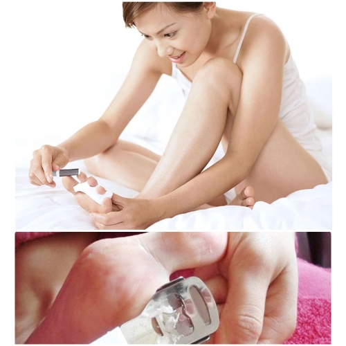 

Stainless Steel Dead Skin Remover Shaver Pedicure Foot Hand Shaver Foot Hand Care